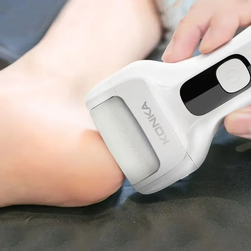 Xiaomi कोन्का इलेक्ट्रिक फुट डेड स्किन रिमूभर फुट स्क्रब फुट एक्सफोलिएटर फाइल एक्सफोलिएटर हिल स्मार्टर ग्राइन्डर पोर्टेबल डिटेचेबल